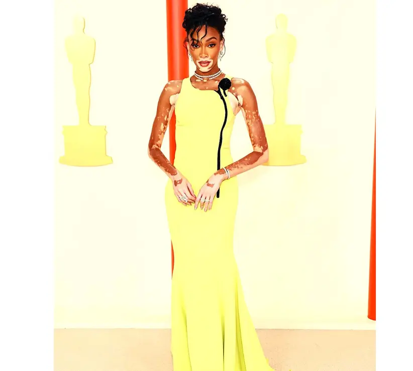 Winnie Harlow, modelo, con vestido de Armani Priv&eacute;. RR SS.