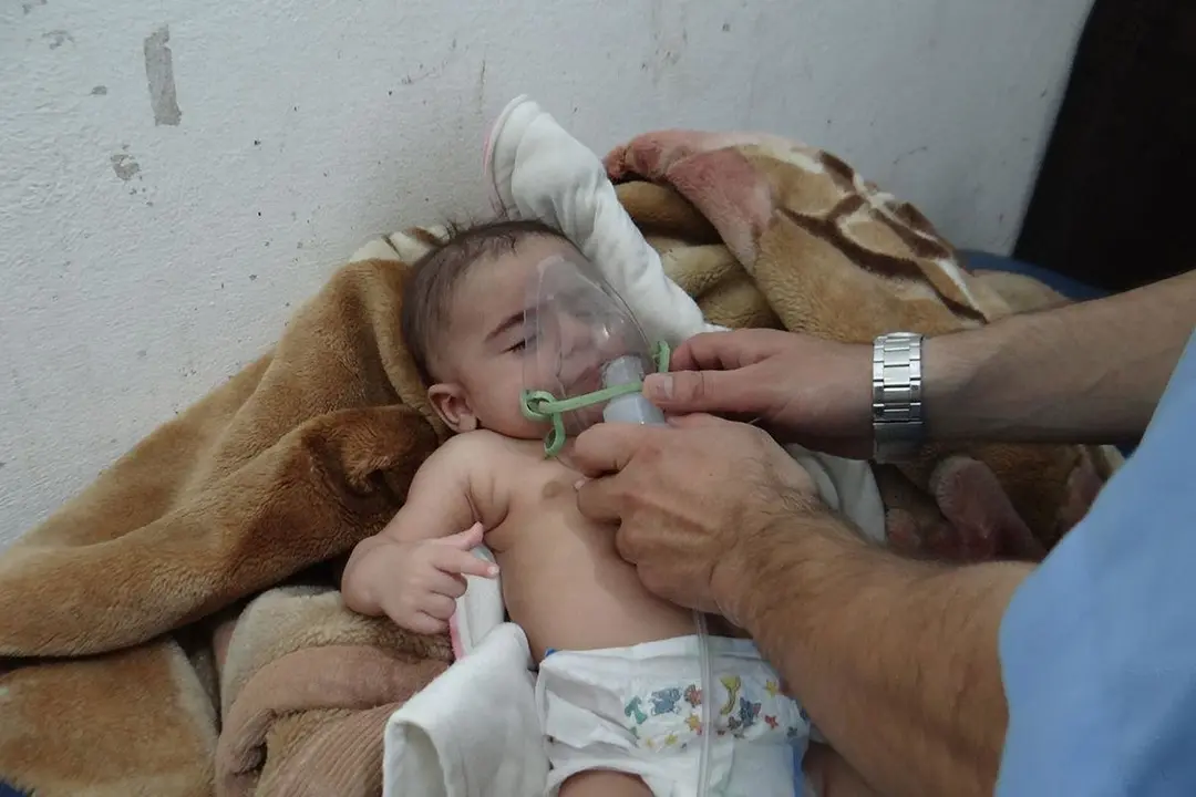Un ni&ntilde;o afectado por el gas. / RRSS
