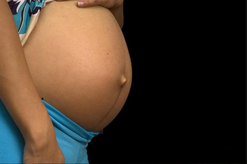 Imagen de una mujer embarazada