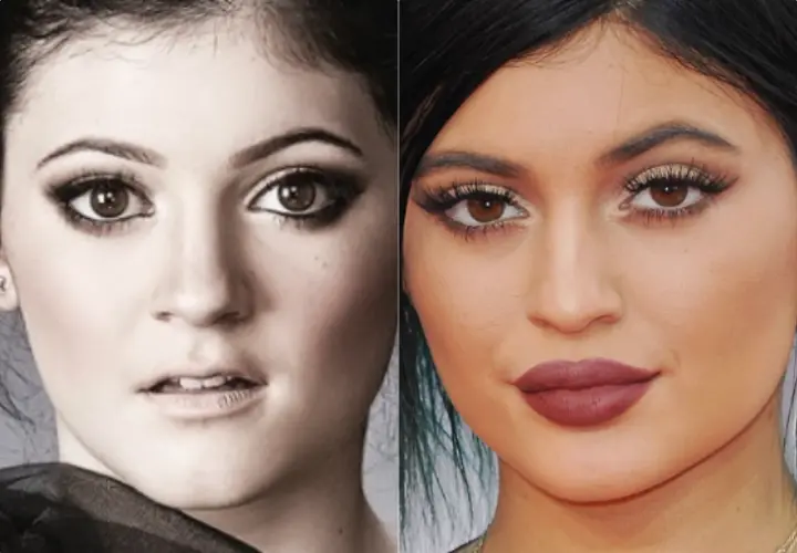Antes y despu&eacute;s de Kylie Jenner. / RR SS