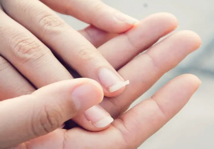 U&ntilde;as debiles. / Pinterest