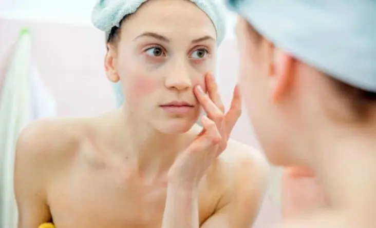 Mujer con ojeras. / Mundiario