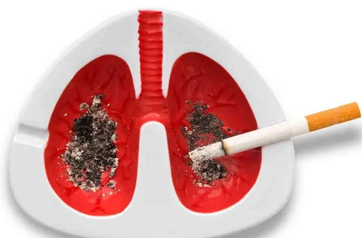 C&aacute;ncer de pulm&oacute;n. / Archivo.