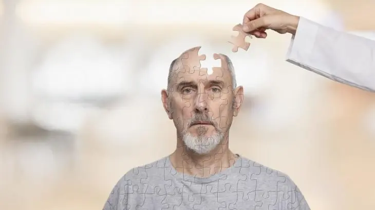Seguimos sin conocer la cura o las causas concretas del Alzheimer. / RRSS