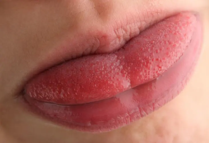 Lengua / Ayur Health Tips.