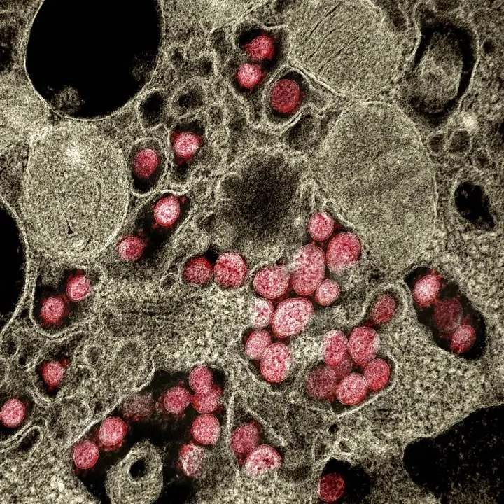 El pulm&oacute;n, un &oacute;rgano vulnerable para este nuevo virus.