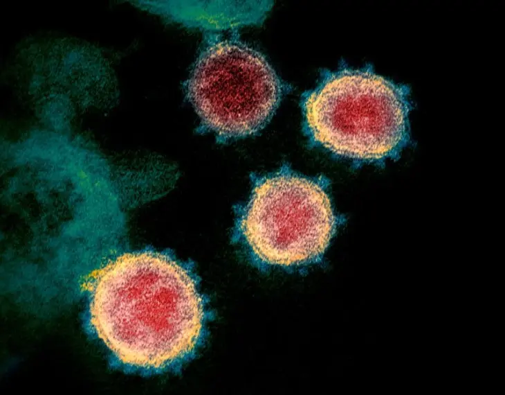 Imagen del nuevo coronavirus tomada con un microscopio electr&oacute;nico. Cr&eacute;dito Institutos Nacionales de Salud de EE. UU
