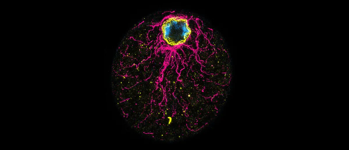 Una c&eacute;lula de la ictiospora C. perkinsii que muestra distintos signos de polaridad. / DudinLab