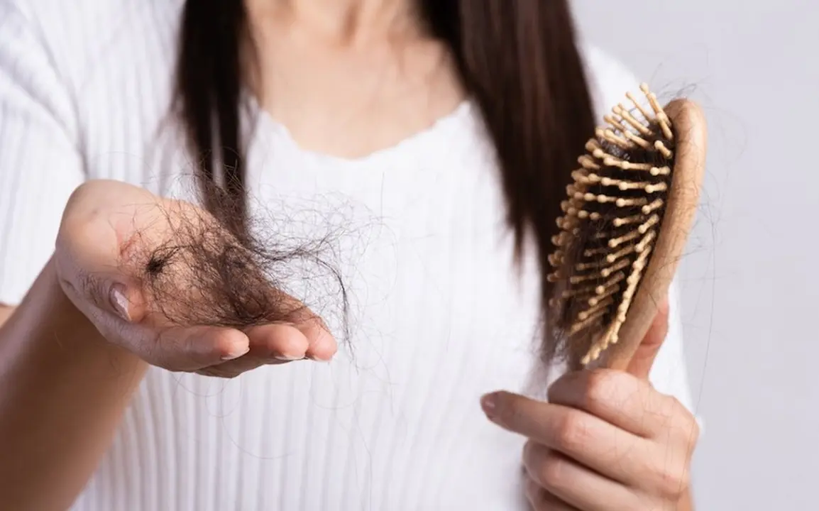 P&eacute;rdida de cabello. / RR SS.