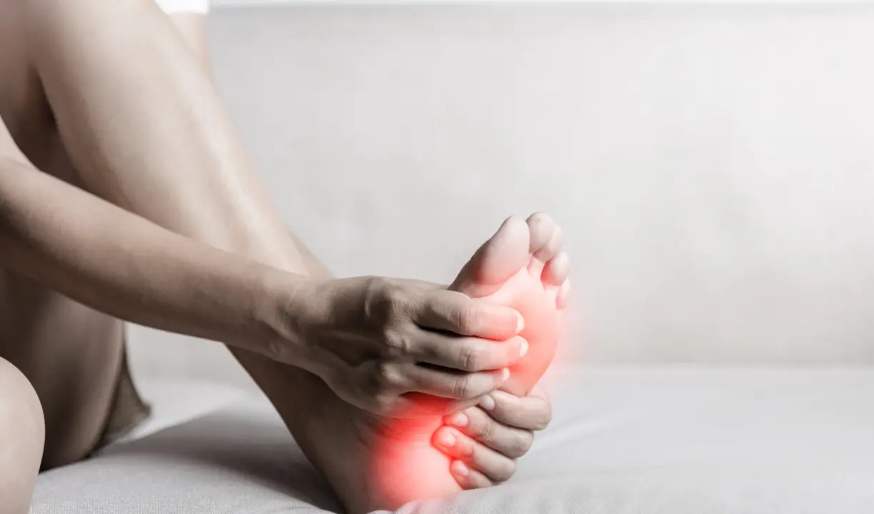 Imagen de una&nbsp;inflamaci&oacute;n de la fascia plantar. / Mundiario.