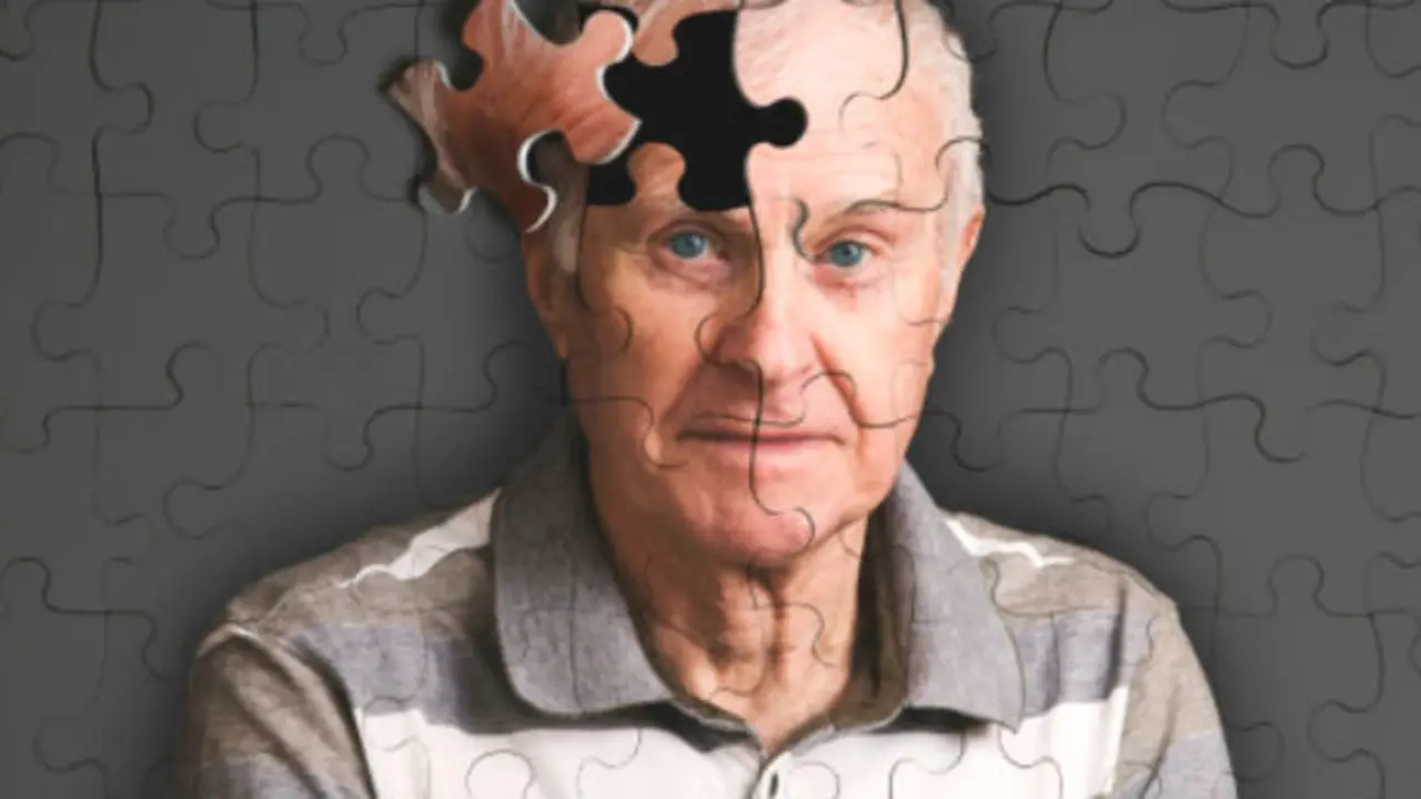 Alzheimer. / RR SS