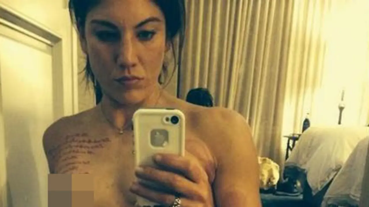 Hope Solo