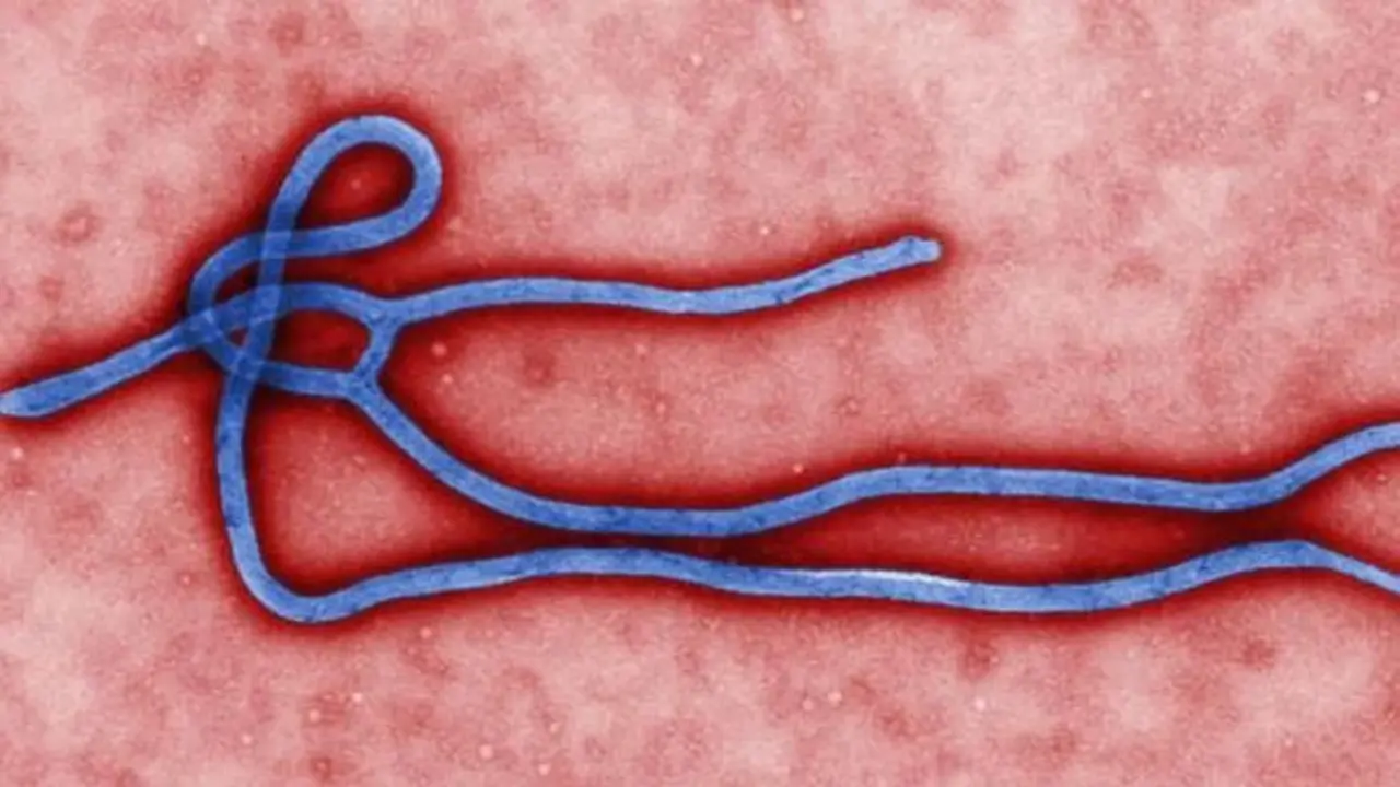 Virus del &eacute;bola.