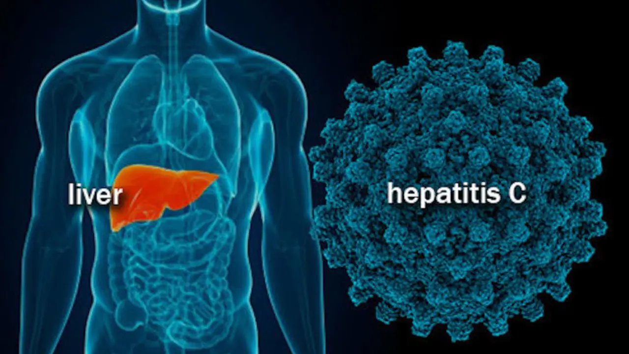 hepatitis c.