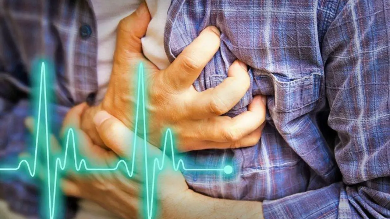 Infarto. / imporntaunika.com