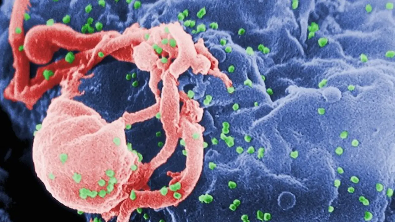Representación del virus del VIH. / RRSS.
