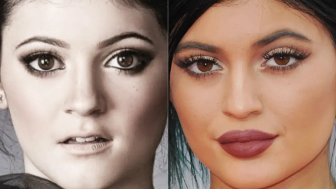 Antes y despu&eacute;s de Kylie Jenner. / RR SS