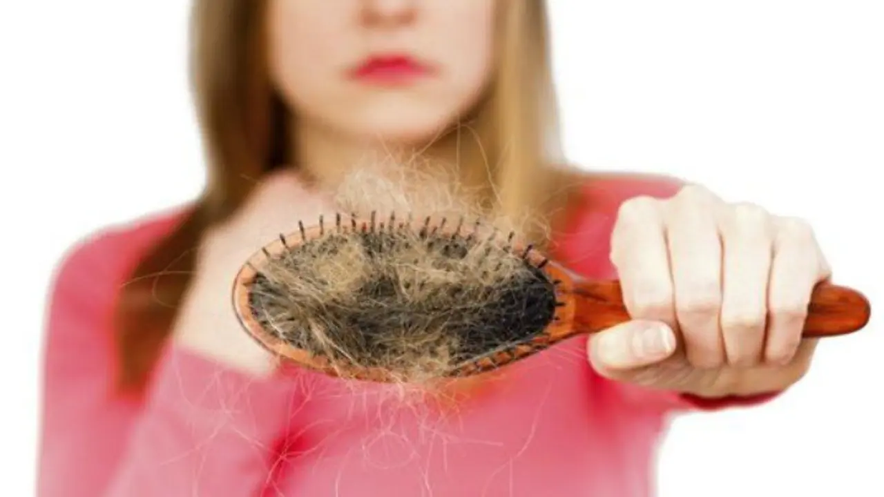 Ca&iacute;da del cabello. / Mundiario