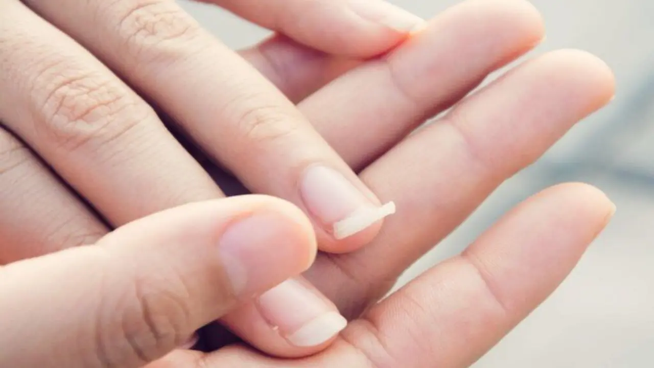 U&ntilde;as debiles. / Pinterest