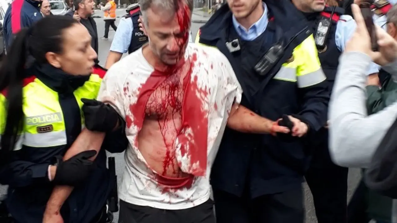 Un herido tras una carga policial. / Twitter