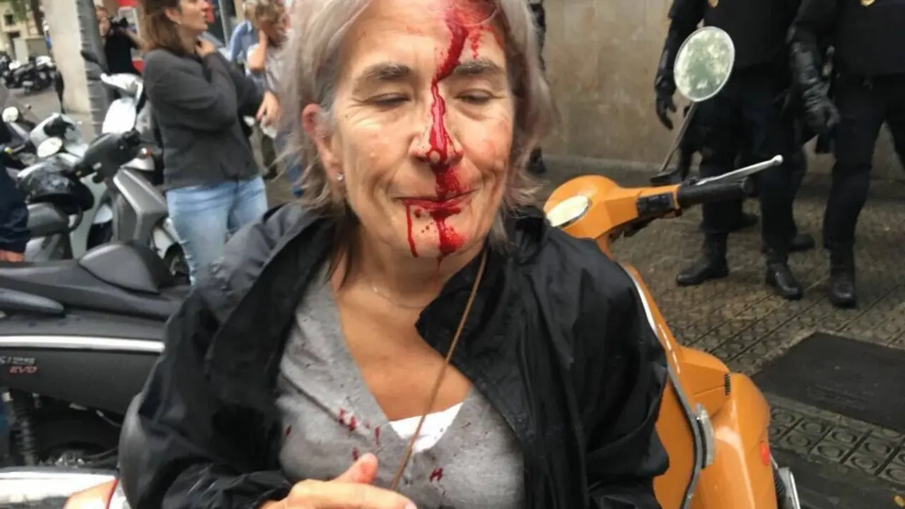 Una de las personas heridas en las cargas policiales. / Twitter