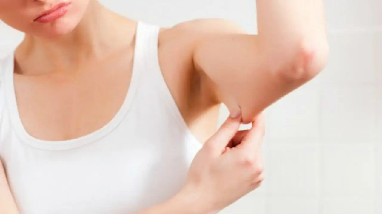Flacidez en los brazos. beautyhealth.tips
