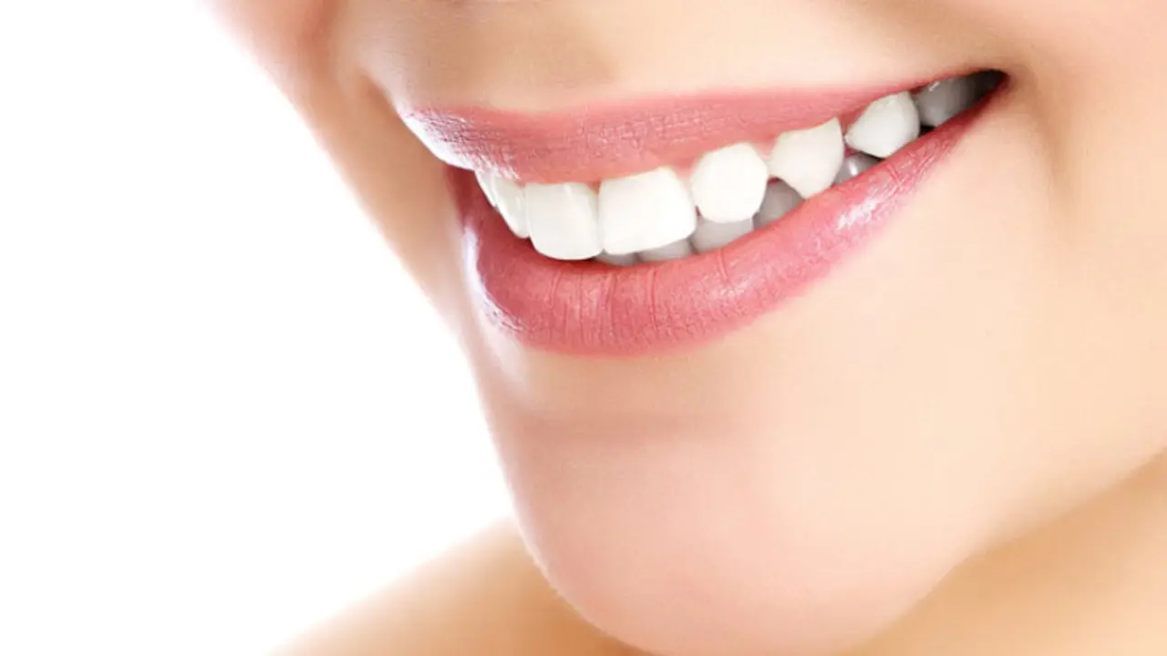 Sonrisa. / RRSS.