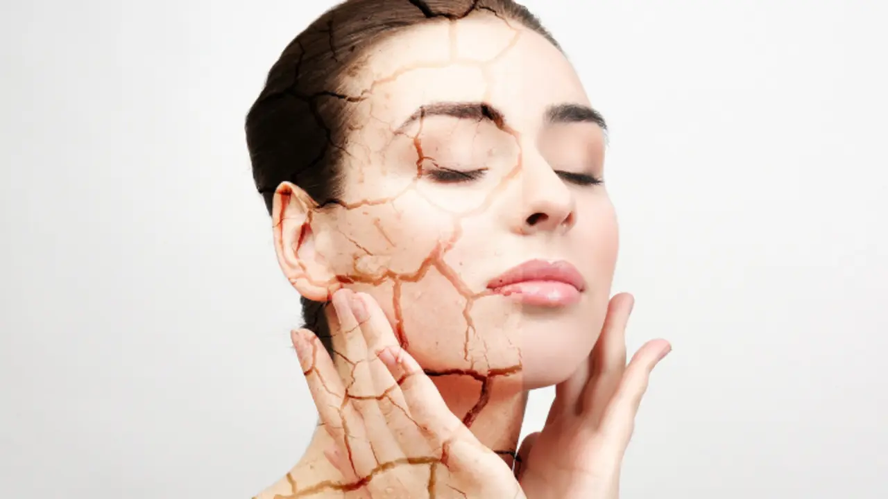 Piel seca. / Affiliated Dermatology.