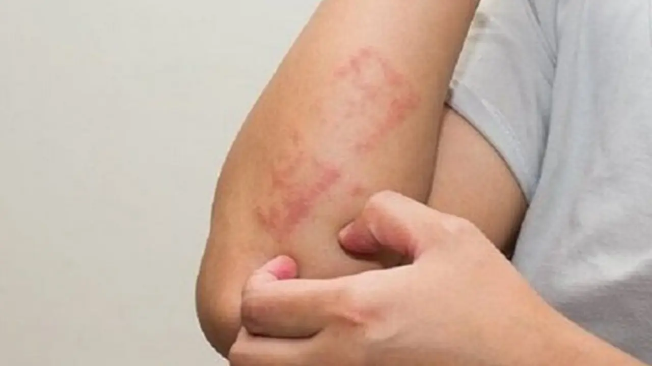 Leucemia. / Diario Correo.
