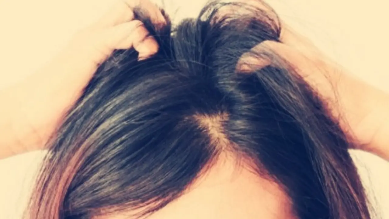 Cabello con mal olor. / RR SS