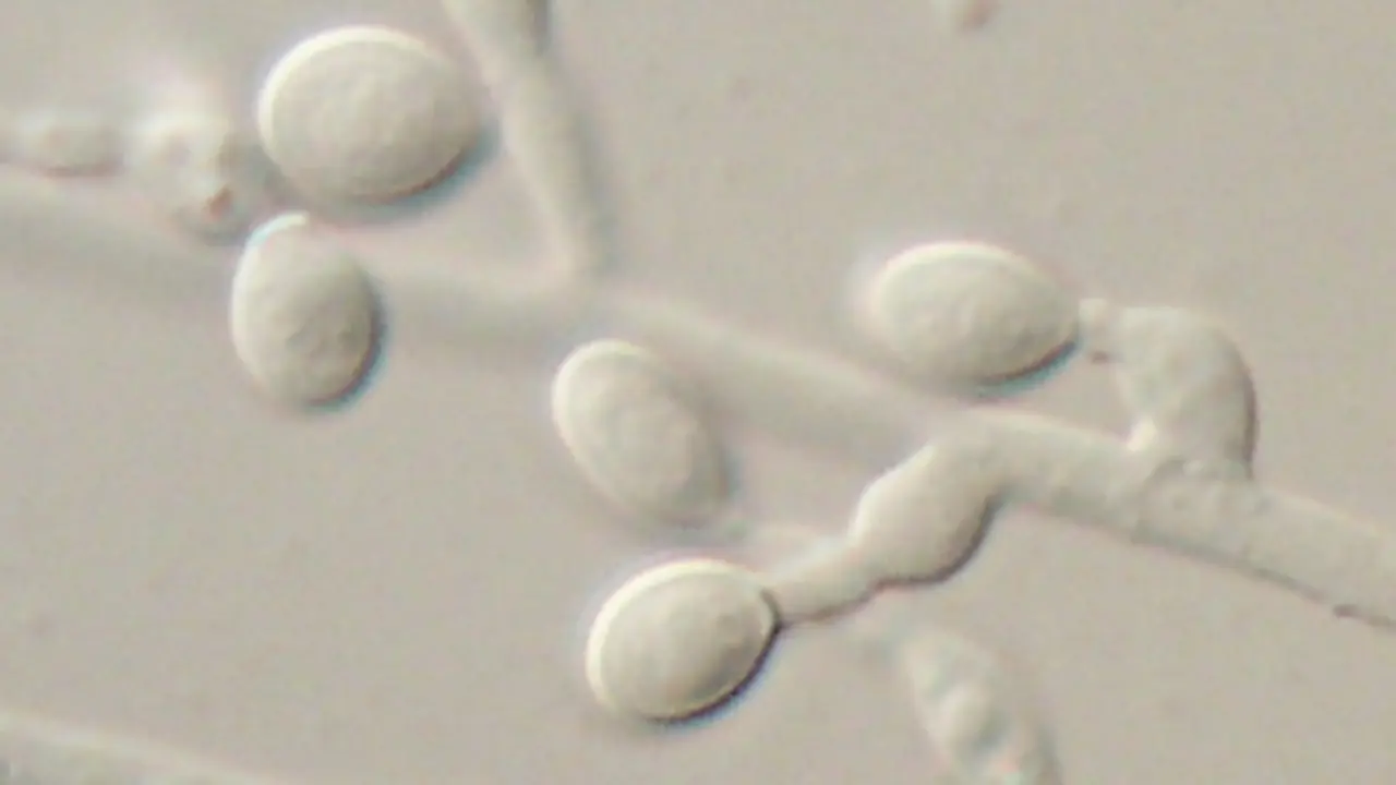 Hongo Lomentospora prolificans. / Wikipedia.