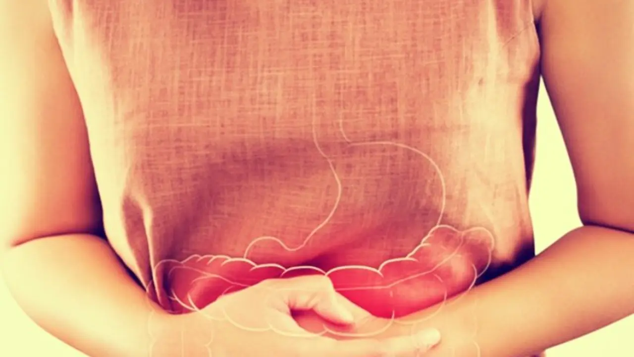 Colitis. RR SS.