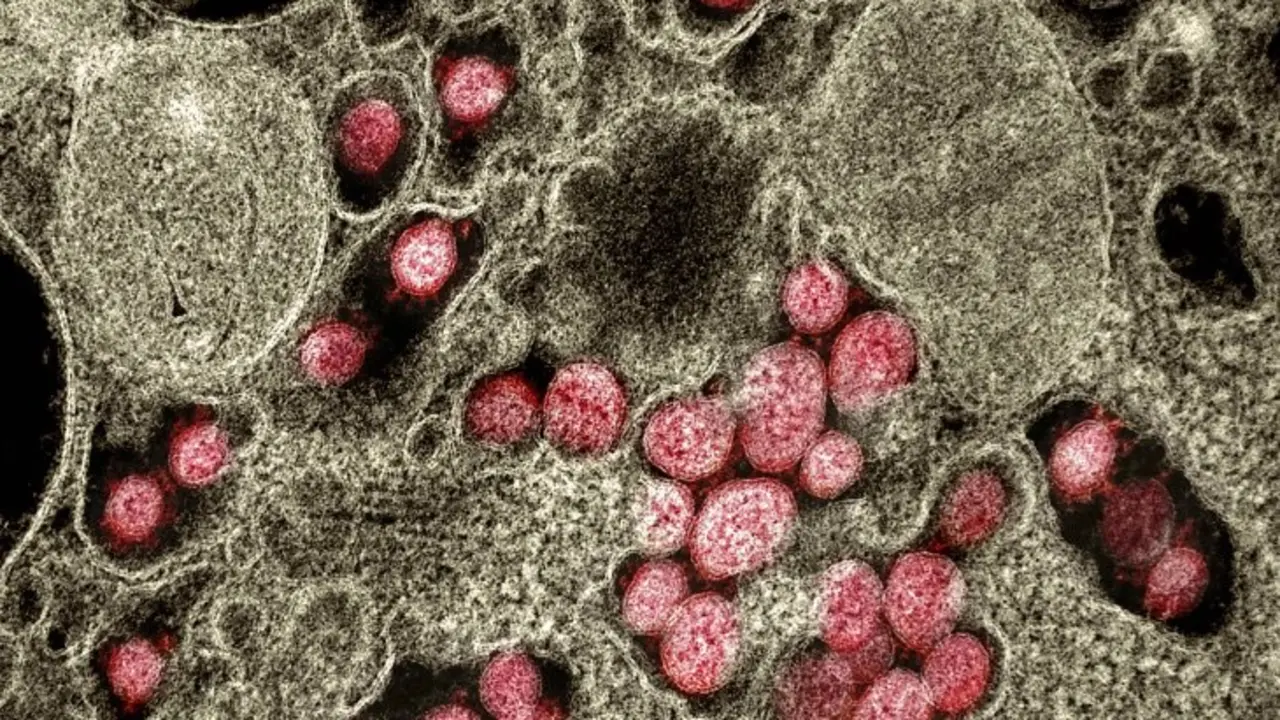 El pulm&oacute;n, un &oacute;rgano vulnerable para este nuevo virus.
