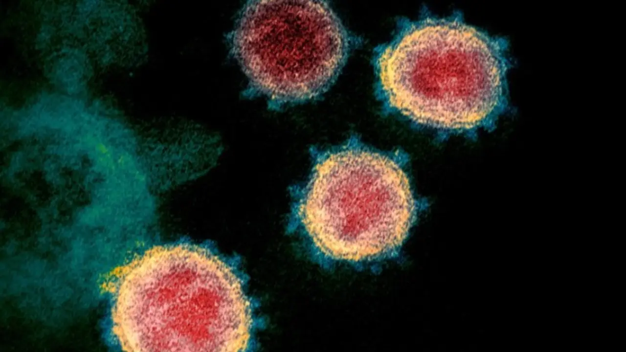 Imagen del nuevo coronavirus tomada con un microscopio electr&oacute;nico. Cr&eacute;dito Institutos Nacionales de Salud de EE. UU