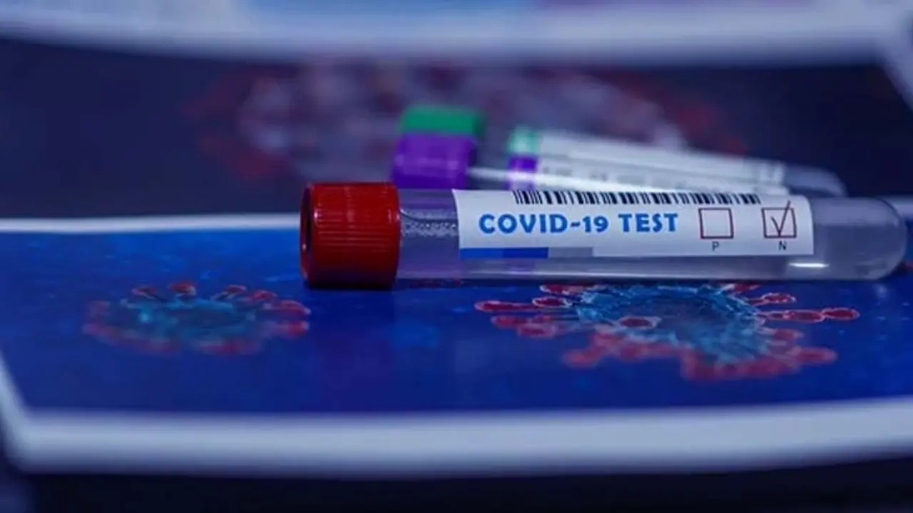 Imagen referencia de un test de coronavirus. / Pixabay