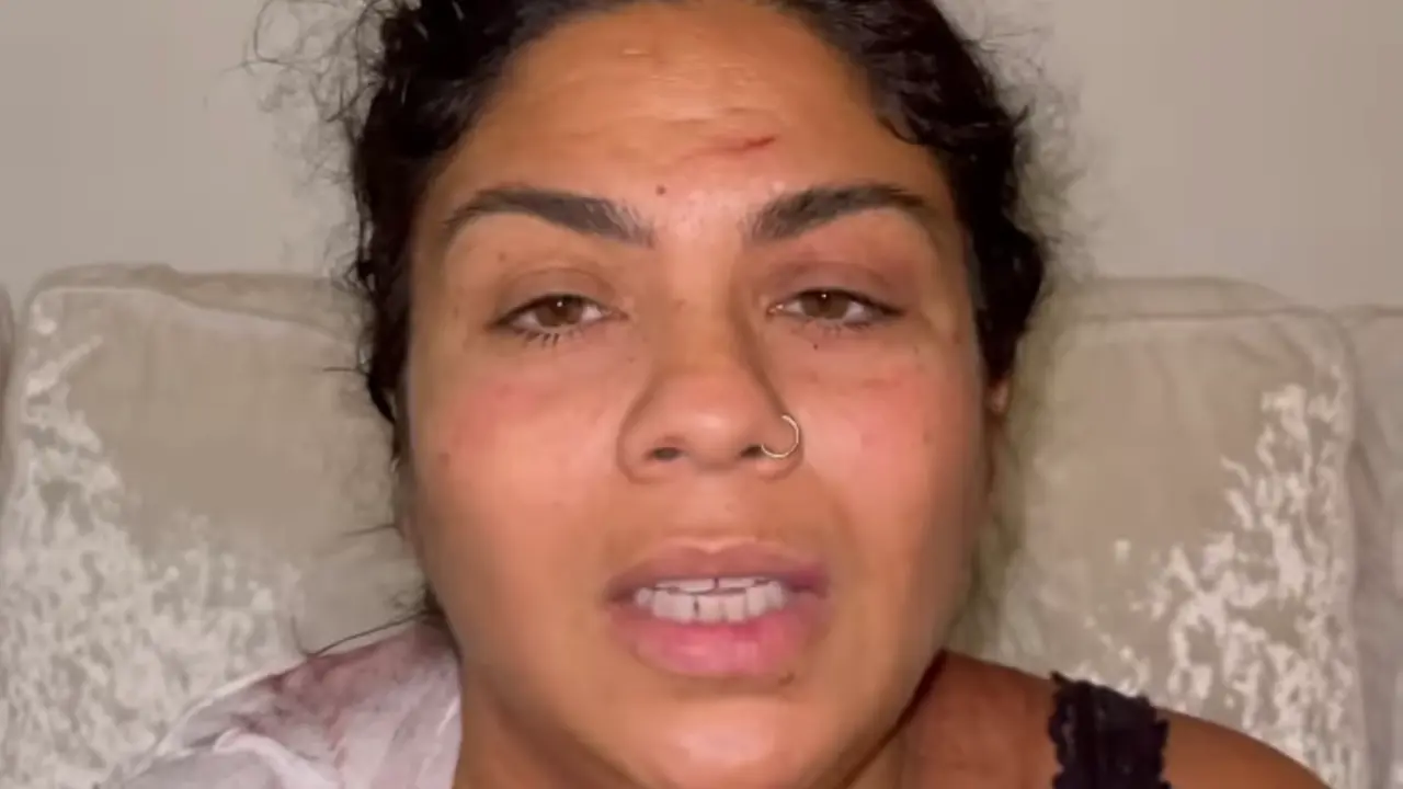 Saray Montoya habla de la agresi&oacute;n / IG @saraymontoya.sm