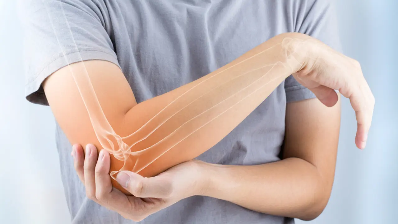 Osteoporosis masculina. / RR SS