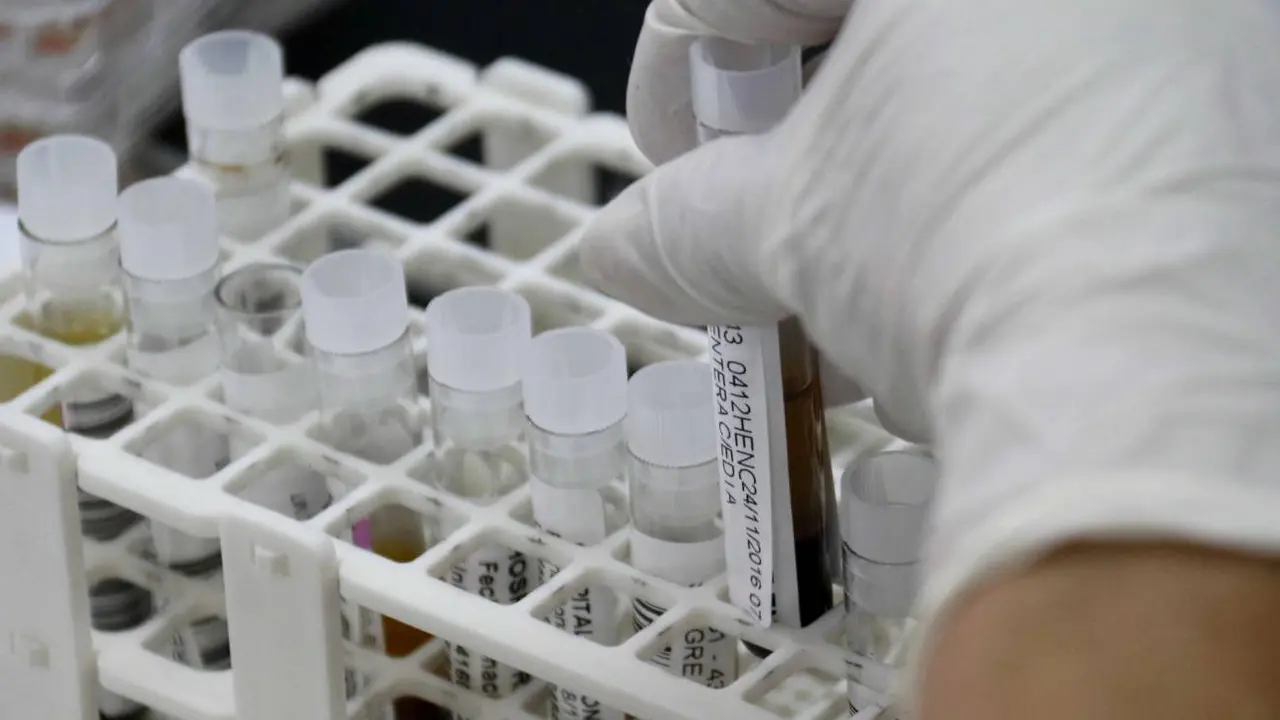 Biopsia l&iacute;quida de c&aacute;ncer de mama. / SINC
