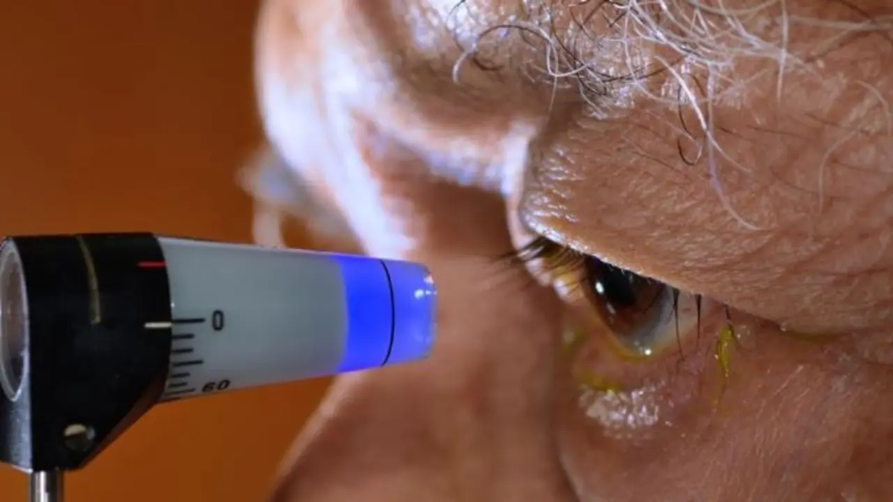 El glaucoma es la segunda causa de ceguera a nivel mundial&nbsp;