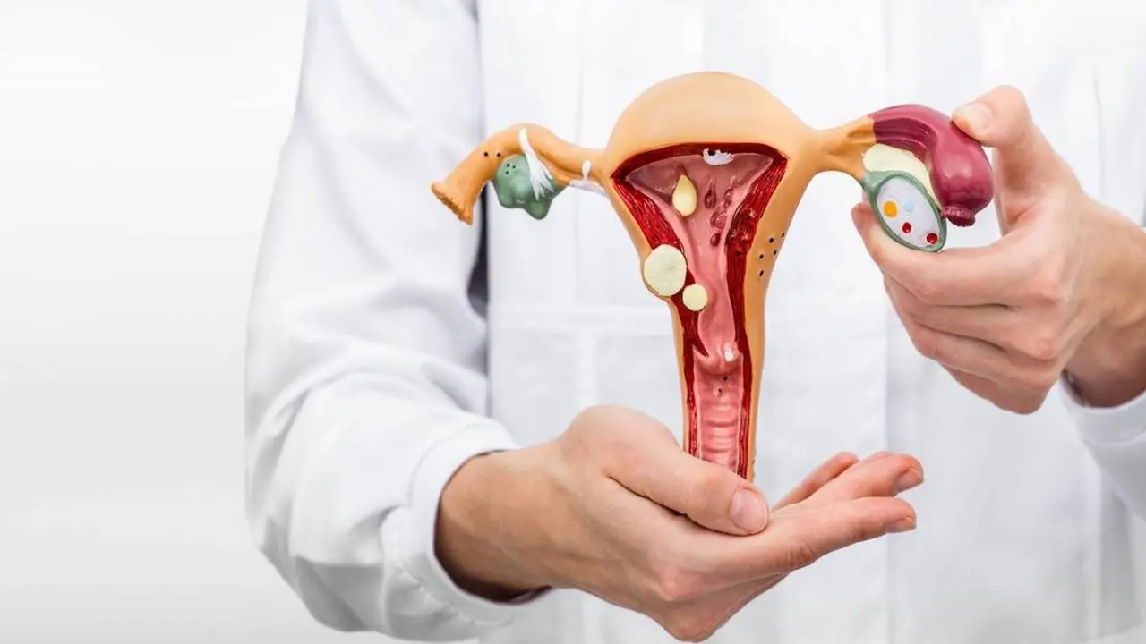 C&aacute;ncer cervicouterino./ RR SS