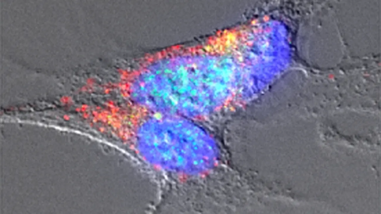 Imagen de microscop&iacute;a de neuronas tratadas con amiloides bacterianos en las que se detectan agregados de &alpha;-sinucle&iacute;na. / IdAB-CSIC.