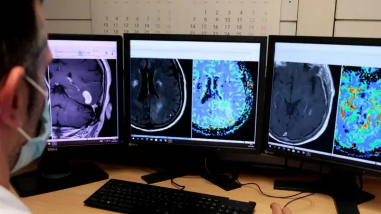 Im&aacute;genes de resonancia magn&eacute;tica del cerebro. / Hospital Universitario de Bellvitge