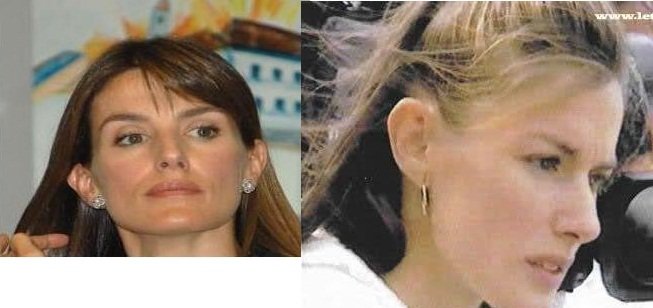 orejas despegadas de la Reina