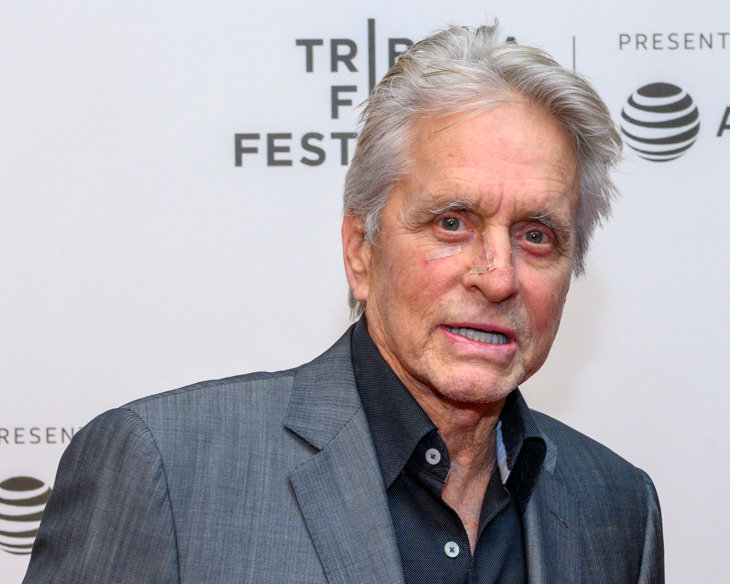 Michael Douglas con tiritas en la cara. Foto: Enrique Shore