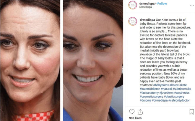 Publicación del médico Munir Somji sobre Kate Middleton. Instagram