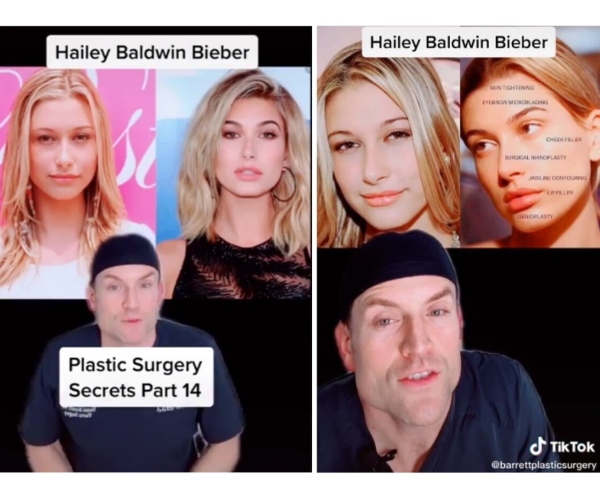 Antes y después de Hailey Baldwin. TikTok.
