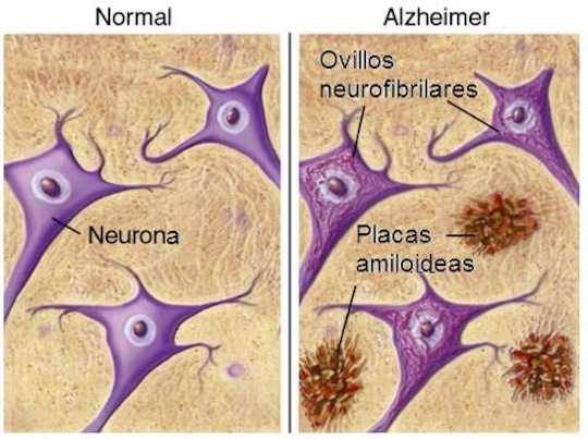 Neuronas. / Revista médica